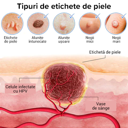 Premium Creme pentru pete de piele, alunițe și veruci